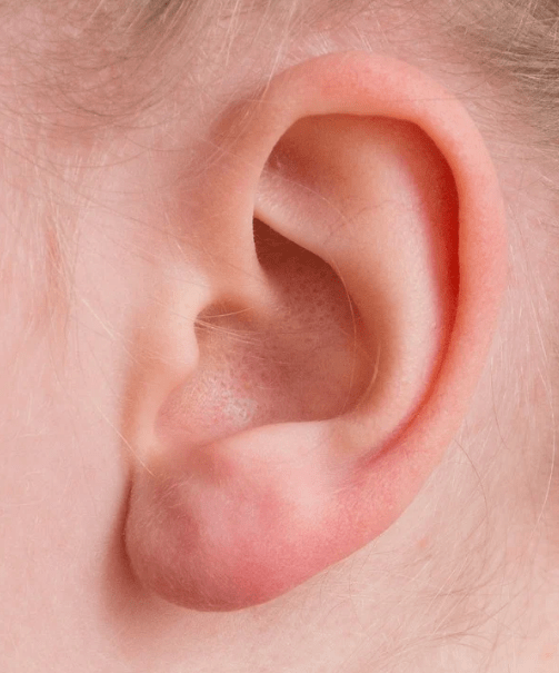 a girl’s ear